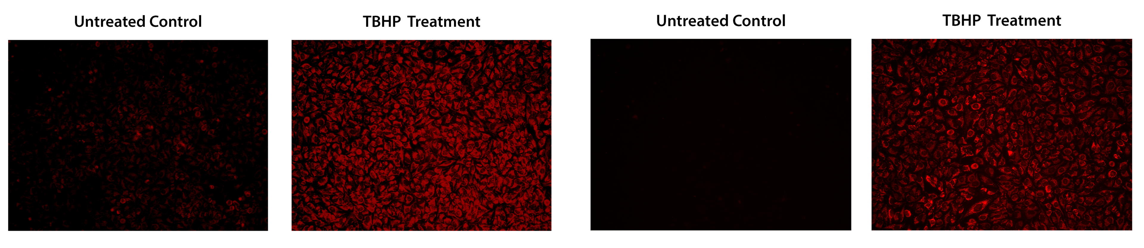 Images of HeLa cells stained with Cell Meter&trade; Fluorimetric Intracellular Total ROS Activity Assay Kit;Images of HeLa cells stained with Cell Meter&trade; Fluorimetric Intracellular Total ROS Activity Assay Kit