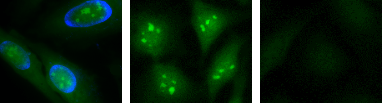 Cell Navigator&reg; Live Cell RNA Imaging Kit;Cells fixed in methanol;After staining