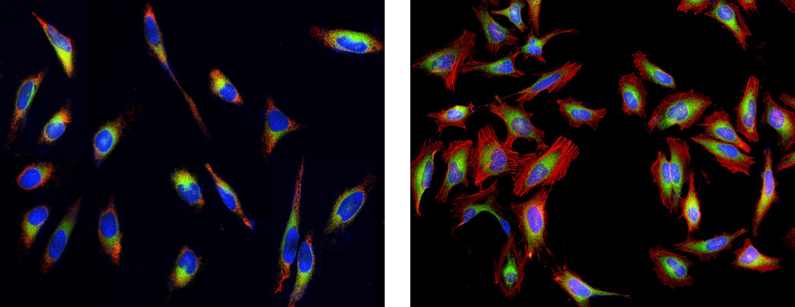 Live cells stained with Cell Navigator<sup>&reg;</sup> Live Cell Endoplasmic Reticulum Staining Kit;Live cells stained with Kit