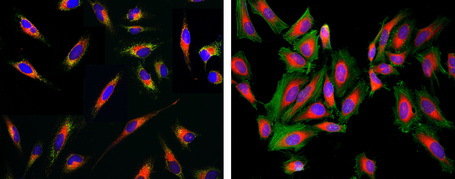 Live cells stained with Cell Navigator<sup>&reg;</sup> Live Cell Endoplasmic Reticulum Staining Kit;Live cells stained with Kit