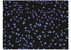 Dead cells stained with Nuclear Blue&trade; DCS1