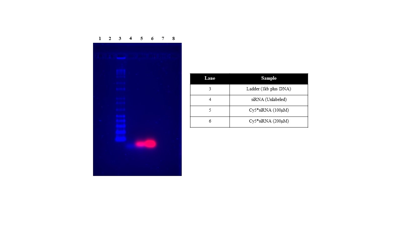 Gel pattern;