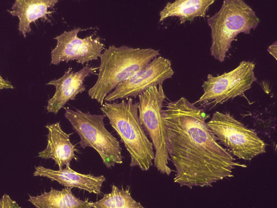 Composite image showing multiplex fluorescent labeling of five key organelles (nuclei, mitochondria, endoplasmic reticulum, cytoskeleton, plasma membrane) in HeLa cells.