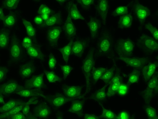<strong>CYTO-13 </strong><strong>live-cell nucleic acid stain</strong><strong>.</strong><br>Live HeLa cells were stained with 2.5uM CYTO-13 (Cat# 17553) for 20 minutes at 37&deg;C, washed once with HH buffer, and then imaged with FITC filter.