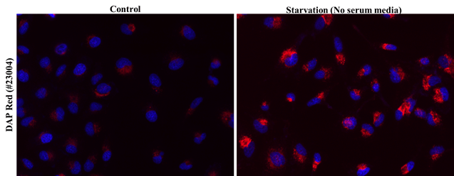 HeLa cells were stained with DAP Red in complete media, followed by serum starvation to induce autophagy. Cells were then counter-stained for nuclear staining using Hoechst 33342 (#22657).