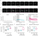 Analysis of 16 Hz ELF-PEMF-dependent Ca2+ influx into SCP-1 cells. Intracellular calcium levels were detected using the fluorescent probe Fluo-8. Time-lapse fluorescent image series of Fluo-8-loaded SCP-1 cells (a) without or (b) with 16 Hz ELF-PEMF exposure. (c) Automated image analysis using the time series analyzer V3 plugin of ImageJ software was used to determine intracellular Ca2+ levels over time. (d) Area under the curve (AUC) was used to determine the net-Ca2+ uptake within the first 24 h. Ca2+ influx into SCP-1 cells, osteogenically differentiated for (e) 7 and (f) 14 days with or without daily exposure to 16 Hz ELF-PEMF, was quantified at λex = 495 nm and λem = 516 nm using a microplate reader, 2 min immediately after starting the ELF-PEMF exposure. N = 3, n ≥ 3. Data are displayed as line graphs with error bands or box plots with individual data points. Data were analyzed by non-parametric one-way ANOVA followed by Friedman’s multiple comparison test, * p < 0.05, ** p < 0.01, *** p < 0.001, and **** p < 0.0001. Source: <b>Intermittent Exposure to a 16 Hz Extremely Low Frequency Pulsed Electromagnetic Field Promotes Osteogenesis In Vitro through Activating Piezo 1-Induced Ca2+ Influx in Osteoprogenitor Cells</b> by Chen, Yangmengfan et.al. <em>Journal of Functional Biomaterials</em>, March 2023.
