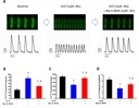 <p>Effects of ACO on [Ca<sup>2+</sup>]i transients in hiPSC-CMs. (A) Representative traces of the [Ca<sup>2+</sup>]i transients recorded in a hiPSC-CM at baseline and with subsequent exposure of ACO and ACO plus Bay K-8644. (B, C, and D) Bar-graphs show the changes in [Ca<sup>2+</sup>]i transient frequency, duration and amplitude in hiPSC-CMs. &dagger;p &lt; 0.01, vs. baseline. &Dagger; p &lt; 0.001, vs. ACO. n = 7. *[Ca<sup>2+</sup>]i transients were recorded in hiPSC-CMs using a LSM-710 laser-scanning confocal microscope (Carl Zeiss, Inc, Germany) with a 40&times;, 1.3 numerical aperture oil immersion objective and axial resolutions of 1.5 &mu;m. Briefly, hiPSC-CMs were loaded with 2 &mu;M Fluo-8 AM (AAT Bioquest, Inc. Sunnyvale, CA, USA) for 15 min at 37&deg;C, and recorded in normal Tyrode&rsquo;s solution. Source: Graph from <strong>L-Type Calcium Channel Inhibition Contributes to the Proarrhythmic Effects of Aconitine in Human Cardiomyocytes</strong> by Jianjun Wu et al., <em>PLOS ONE</em>, Jan. 2017.&nbsp;</p>