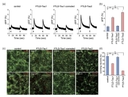 Calcium dysregulation and neuronal loss of FTLD-Tau neurons. (a,b) Calcium imaging after electrical stimulation. Intracellular Ca<sup>2+</sup> levels, elevated by electrical stimulation, were higher in FTLD-Tau neurons than in control (n&thinsp;=&thinsp;6; one-way ANOVA, p&thinsp;&lt;&thinsp;0.05; post hoc test, *p&thinsp;&lt;&thinsp;0.05). (c,d) Immunofluorescence staining of &beta;III tubulin and NeuN on Days 8 and 21 in control and FTLD-Tau neurons. Survival of FTLD-Tau neurons from Day 8 to Day 21 was decreased compared to control neurons (n&thinsp;=&thinsp;6; one-way ANOVA, p&thinsp;&lt;&thinsp;0.05; post hoc test, *p&thinsp;&lt;&thinsp;0.05). Source: <strong>Calcium dysregulation contributes to neurodegeneration in FTLD patient iPSC-derived neurons </strong>by Imamura et al., <em>Scientific Reports</em>, Oct. 2016.