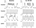 <p>Ca<sup>2+</sup> imaging of spontaneously beating hiPSC-CMs. Representative tracings of Ca<sup>2+</sup> imaging in spontaneously contracting control- and CPVT-hiPSC-CMs. *The hiPSC-CMs were dispersed with collagenase B and Trypsin EDTA and plated onto glass coverslips coated with fibronectin (BD Biosciences, San Jose, CA, USA). After 5&ndash;7 days, dissociated hiPSC-CMs on a coverslip were loaded with 2 &micro;mol/L Fluo-8 (AAT Bioquest, Sunnyvale, CA, USA) in the culture medium described above. Source: Graph from <strong>Patient-Specific Human Induced Pluripotent Stem Cell Model Assessed with Electrical Pacing Validates S107 as a Potential Therapeutic Agent for Catecholaminergic Polymorphic Ventricular Tachycardia</strong> by Kenichi Sasaki, et al., <em>PLOS ONE</em>, Oct. 2016.&nbsp;</p>