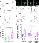 Activation of CB<sub>1</sub>-Rs evokes Ca<sup>2+</sup>&nbsp;transients in cell bodies of cultured spinal astrocytes. (a&ndash;c) Graphical representation of changes in [Ca<sup>2+</sup>]<sub>i</sub>&nbsp;recorded in rat cultured astrocytes following the application of 10&thinsp;&micro;M 2-AG (a), 10&thinsp;&micro;M WIN (b), and 10 &micro;M anandamide (AEA) (c). (d) Box plot illustrating the amplitudes of calcium transients of rat cultured astrocytes in response to the application of 10&thinsp;&micro;M 2-AG, 10&thinsp;&micro;M WIN, and 10&thinsp;&micro;M AEA. Asterisks indicate significant differences between the amplitudes of calcium transients evoked by 2-AG, WIN and AEA (p&thinsp;=&thinsp;0.0007, 2-AG vs AEA; p&thinsp;=&thinsp;0.0354 WIN vs AEA).&nbsp;e: Micrographs showing the fluorescent intensity of a Fluo-8-AM-loaded cultured rat spinal astrocyte at different time points after the application of 10 &micro;M WIN. Scale bar: 50&thinsp;&micro;m. (f&ndash;i) Graphical representations of the time courses of calcium transients evoked by the application of 10&thinsp;&micro;M WIN (f), 10&thinsp;&micro;M anandamide and 180&thinsp;&micro;M ATP (g) in cultured rat spinal astrocytes, and 10&thinsp;&micro;M WIN and 180&thinsp;&micro;M ATP in astrocytes cultured from wild type (h) and CB<sub>1</sub>-R knock out (i) mice. (j) Box plot showing the amplitudes of the calcium transients normalized to ATP responses in the responding cells cultured from rats, wild type mice, and CB<sub>1</sub>&ndash;R knock out mice. Dashed and continuous lines within the boxes represent the mean and median values of the data sets, respectively. Asterisks indicate significant difference between the amplitudes of calcium transients evoked by WIN in wild type and CB<sub>1</sub>-R knock out mice (p&thinsp;=&thinsp;0.0118). Source: <strong>CB1 receptor activation induces intracellular Ca<sup>2+</sup> mobilization and 2-arachidonoylglycerol release in rodent spinal cord astrocytes</strong> by Hegyi et al., <em>Scientific Reports</em>, July 2018.
