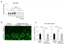 Supplementary Figures (a) CK activity was measured after the addition of RR, TRP family channel inhibitor. CK values were normalised with CK value of DMSO treated samples. (b) Images of myotubes with fluorescent Fluo-8 intensity, visualising Ca<sup>2+</sup> influx. Scale bar, 200 &micro;m. (c) Ca<sup>2+</sup> uptake was measured by Fluo-8 intensity in myotubes and quantified. Six myotubes were selected from each Control-, DMD-, and DMD-Myocytes+AO, skeletal muscle cells. Relative fluorescence intensities were normalized to the control intensity in each sample. **P &lt; 0.01 Triplicate experiments for each condition. n = 3. Source: <strong>Early pathogenesis of Duchenne muscular dystrophy modelled in patient-derived human induced pluripotent stem cells </strong>by Shoji et al,. <em>Scientific Reports,</em> Aug. 2015.