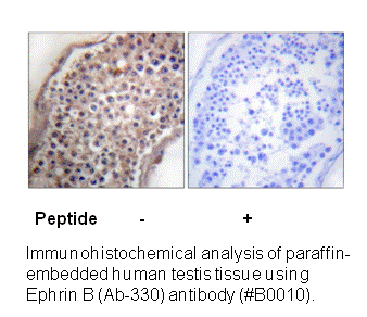 Product image for EFNB1/2 (Ab-330) Antibody