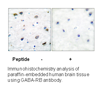 Product image for GABA-RB (Ab-434) Antibody