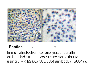 Product image for LIMK1/2 (Ab-508/505) Antibody