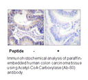 Product image for Acetyl-CoA Carboxylase (Ab-80) Antibody