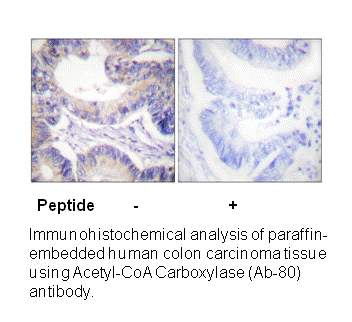 Product image for Acetyl-CoA Carboxylase (Ab-80) Antibody