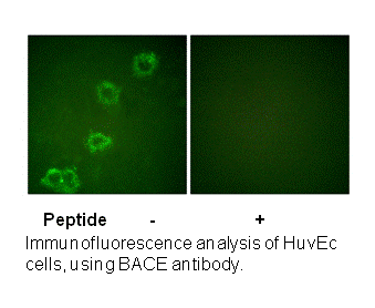 Product image for BACE (Ab-498) Antibody