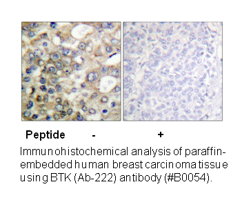 Product image for BTK (Ab-222) Antibody