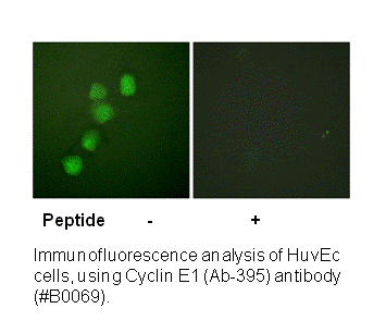 Product image for Cyclin E1 (Ab-395) Antibody
