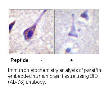Product image for BID (Ab-78) Antibody