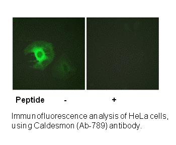 Product image for Caldesmon (Ab-789) Antibody