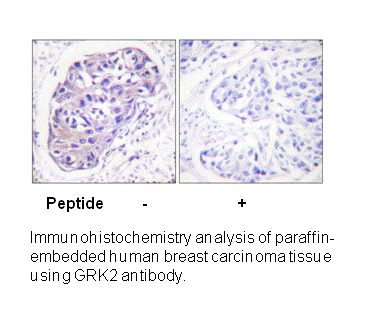 Product image for GRK2 (Ab-29) Antibody