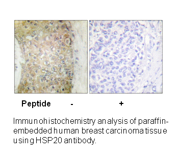 Product image for HSP20 (Ab-16) Antibody