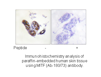 Product image for MITF (Ab-180/73) Antibody