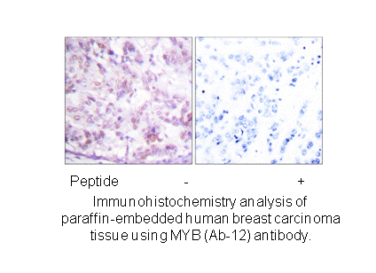 Product image for MYB (Ab-12) Antibody