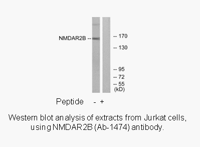 Product image for NMDAR2B (Ab-1474) Antibody