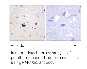 Product image for PAK1/2/3 (Ab-144/141/139) Antibody