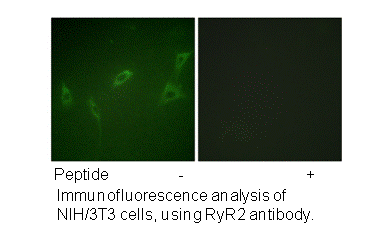 Product image for RyR2 (Ab-2808) Antibody