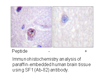 Product image for SF1 (Ab-82) Antibody