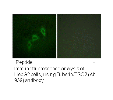 Product image for Tuberin/TSC2 (Ab-939) Antibody