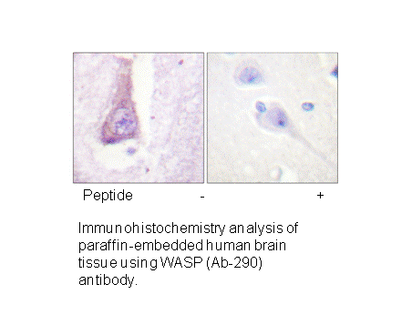 Product image for WASP (Ab-290) Antibody