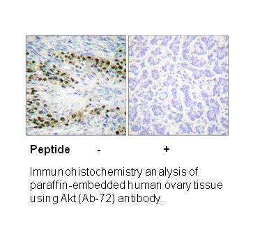 Product image for Akt (Ab-72) Antibody