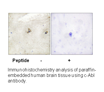 Product image for c-Abl (Ab-245) Antibody
