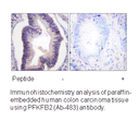 Product image for Fructose 6 Phosphate Kinase (Ab-483) Antibody