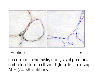 Product image for AhR (Ab-36) Antibody