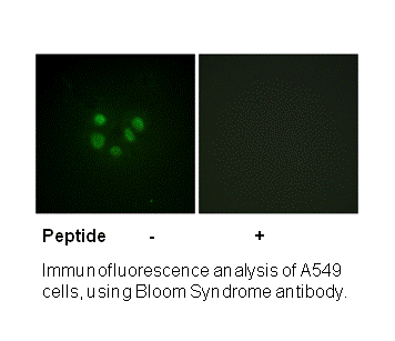 Product image for Bloom Syndrome (Ab-99) Antibody