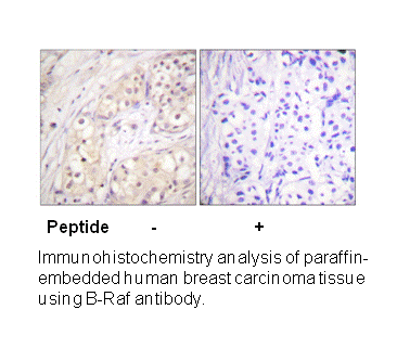 Product image for B-RAF (Ab-598) Antibody