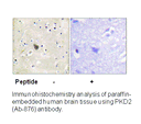 Product image for PKD2 (Ab-876) Antibody