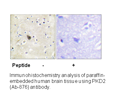 Product image for PKD2 (Ab-876) Antibody