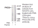 Product image for PKD2 (Ab-876) Antibody