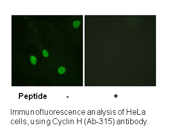 Product image for Cyclin H (Ab-315) Antibody