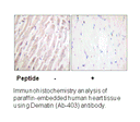 Product image for Dematin (Ab-403) Antibody