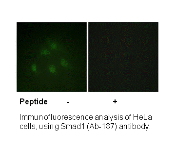 Product image for Smad1 (Ab-187) Antibody