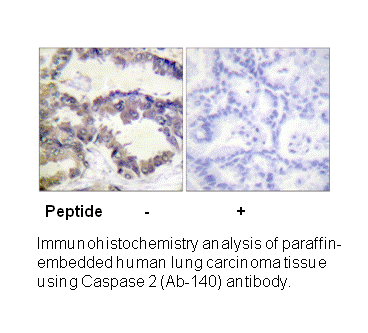 Product image for Caspase 2 (Ab-157) Antibody