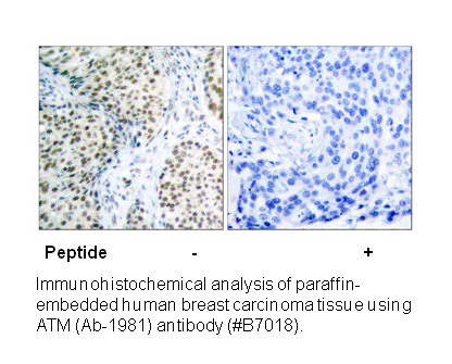 Product image for ATM (Ab-1981) Antibody