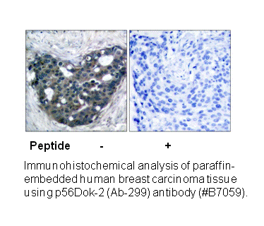 Product image for p56 Dok-2 (Ab-299) Antibody